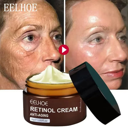 Retinol Wrinkle Remover Face Cream - Firming, Anti-Aging & Moisturizing Skin Care