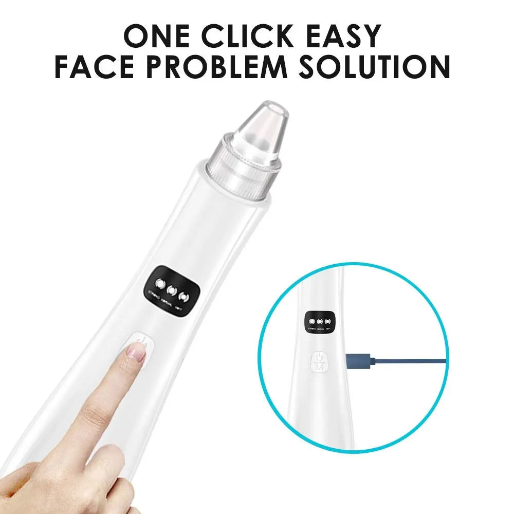 3-Suction Mode Face Cleansing Beauty Machine - Blackhead Removal & Dead Skin Remover Vacuum