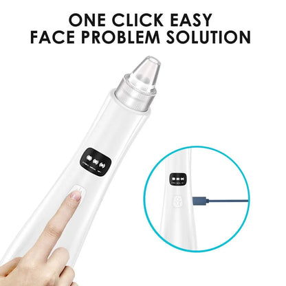 3-Suction Mode Face Cleansing Beauty Machine - Blackhead Removal & Dead Skin Remover Vacuum