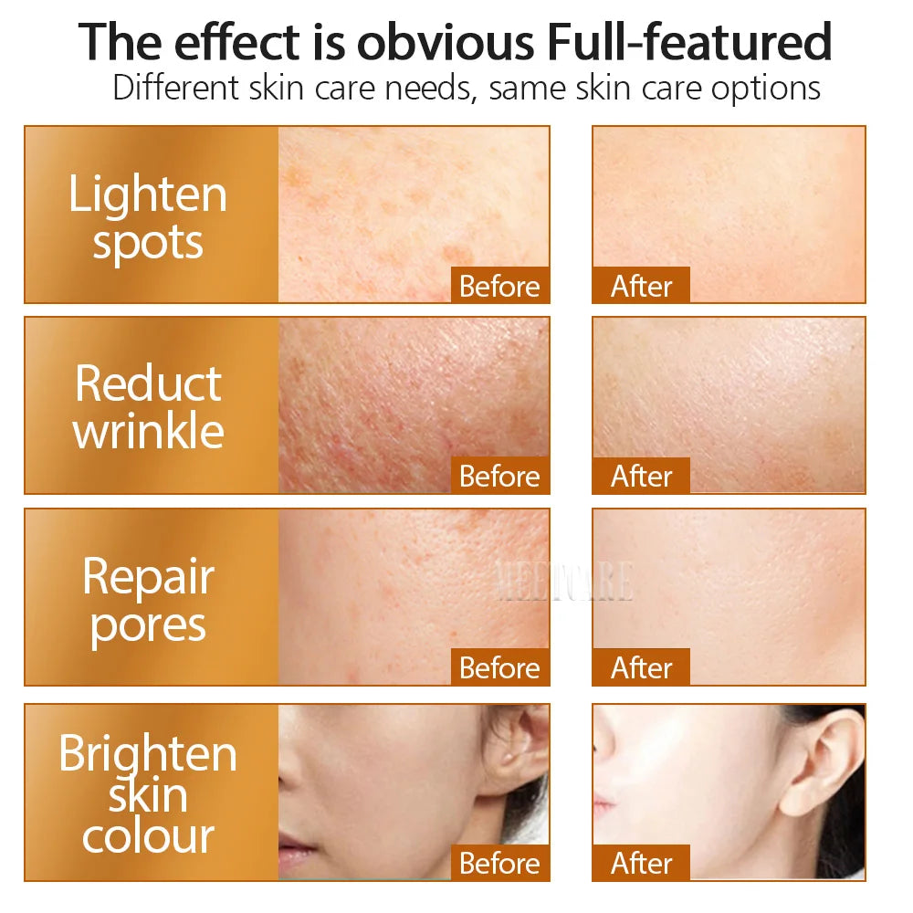 ZGTS 192 Needle Derma Roller - 0.25mm Microneedling for Face, Body, Scar & Stretch Mark Removal