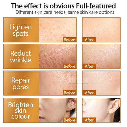 ZGTS 192 Needle Derma Roller - 0.25mm Microneedling for Face, Body, Scar & Stretch Mark Removal