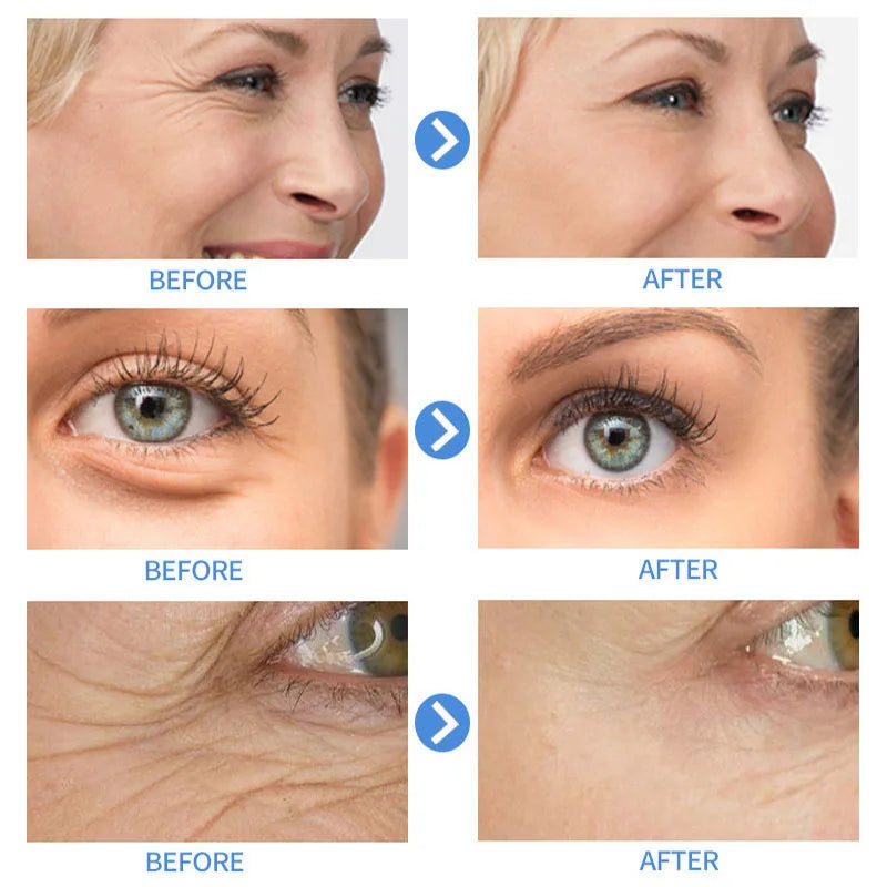 Retinol Wrinkle Remover Face Cream - Firming, Anti-Aging & Moisturizing Skin Care