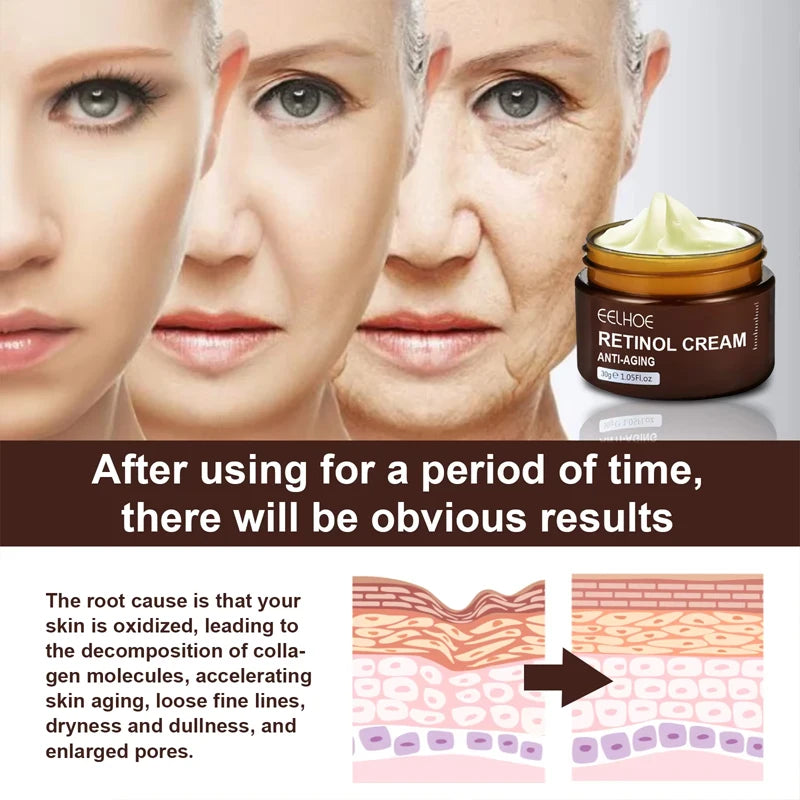 Retinol Wrinkle Remover Face Cream - Firming, Anti-Aging & Moisturizing Skin Care