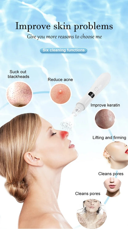 3-Suction Mode Face Cleansing Beauty Machine - Blackhead Removal & Dead Skin Remover Vacuum