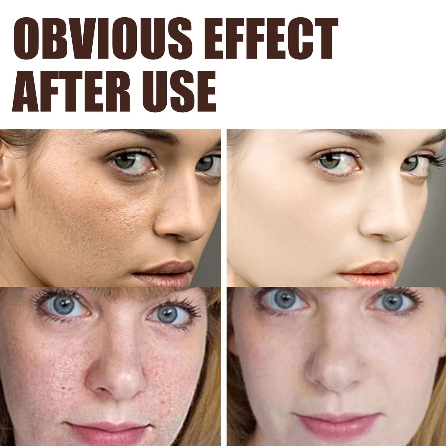 Retinol Wrinkle Remover Face Cream - Firming, Anti-Aging & Moisturizing Skin Care