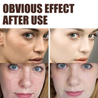 Retinol Wrinkle Remover Face Cream - Firming, Anti-Aging & Moisturizing Skin Care