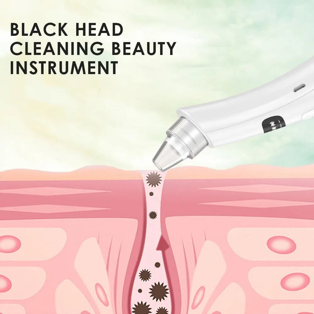 3-Suction Mode Face Cleansing Beauty Machine - Blackhead Removal & Dead Skin Remover Vacuum