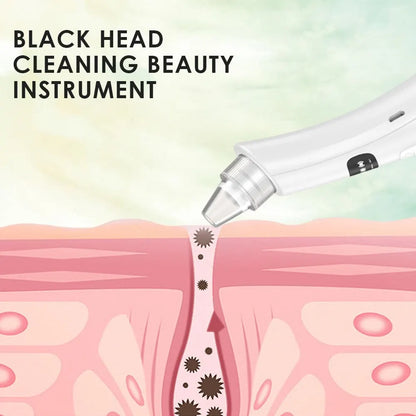 3-Suction Mode Face Cleansing Beauty Machine - Blackhead Removal & Dead Skin Remover Vacuum
