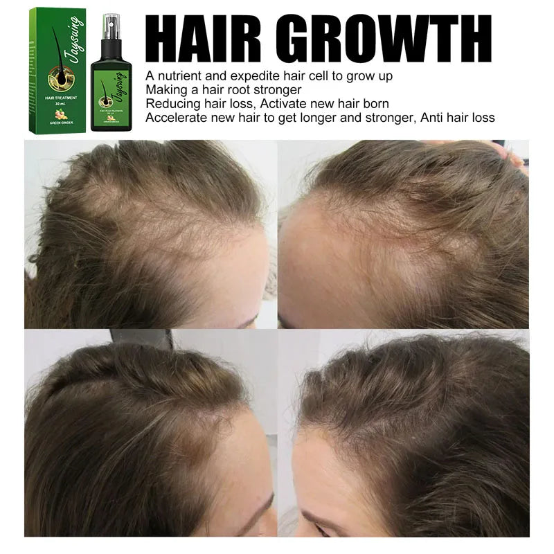 Fast Hair Growth Serum Spray - Anti Hair Loss & Baldness Treatment, Scalp Repair for Men & Women