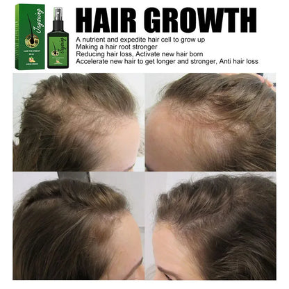 Fast Hair Growth Serum Spray - Anti Hair Loss & Baldness Treatment, Scalp Repair for Men & Women