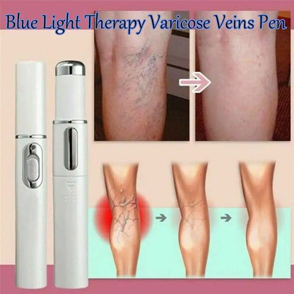 Blue Light Therapy Acne Laser Pen - LED Face Light for Scar & Wrinkle Removal Skin Care Device