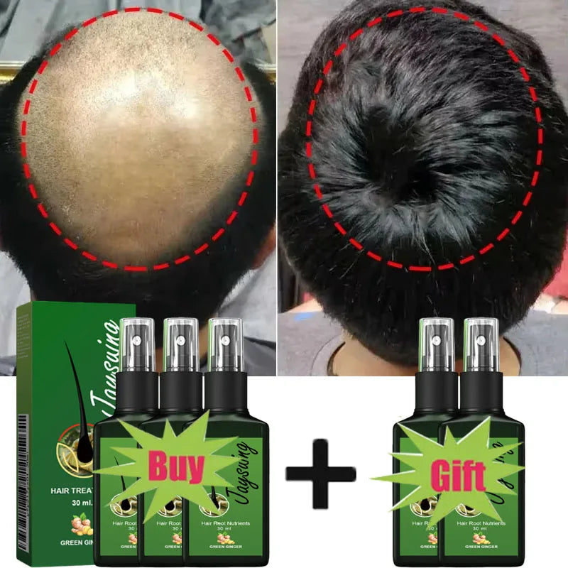 Fast Hair Growth Serum Spray - Anti Hair Loss & Baldness Treatment, Scalp Repair for Men & Women