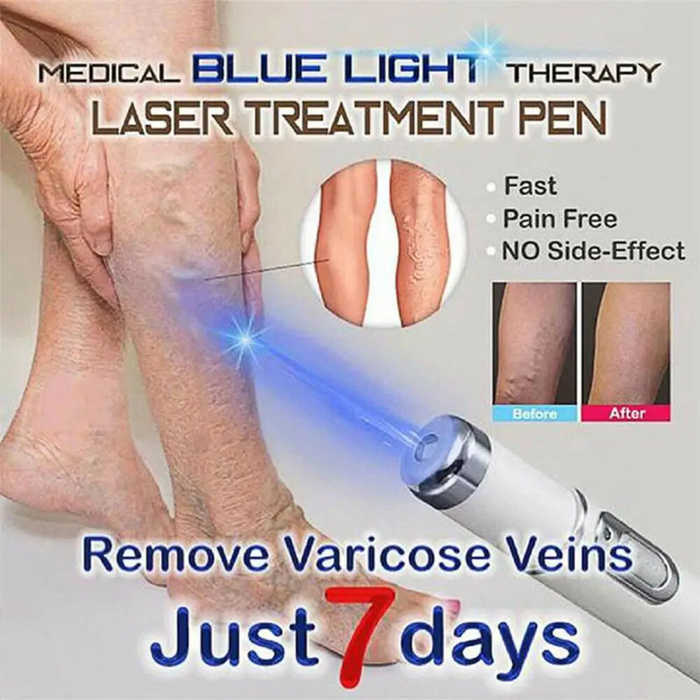 Blue Light Therapy Acne Laser Pen - LED Face Light for Scar & Wrinkle Removal Skin Care Device