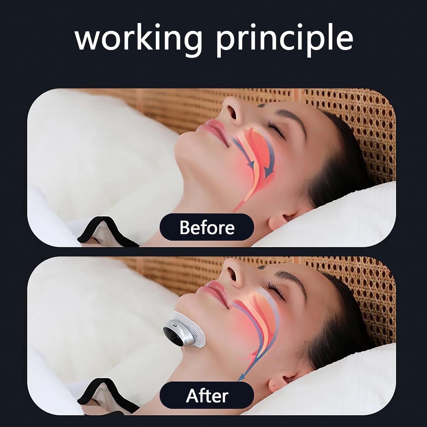 Anti Snoring Devices Electric, ElectricAnti Snoring Bean, Snoring SleepDevice, Easy to use Portable ThreeSpeed Adjustment, Suita