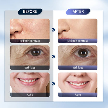 foreverlily LED Face Mask PDT Machine - 7-Color Photon Skin Rejuvenation & Nano Spray for Face & Body