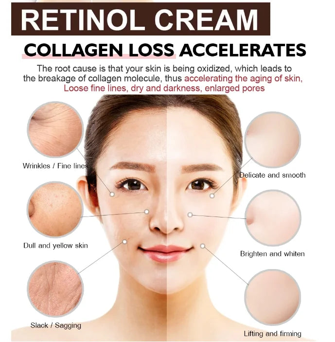 Retinol Wrinkle Remover Face Cream - Firming, Anti-Aging & Moisturizing Skin Care