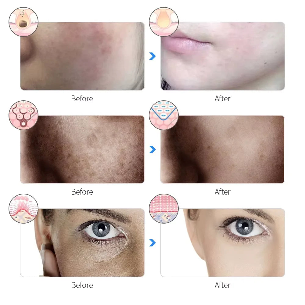 7-Color LED Photon Facial Mask - Skin Rejuvenation & Tightening for Face & Neck