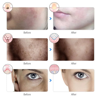 7-Color LED Photon Facial Mask - Skin Rejuvenation & Tightening for Face & Neck