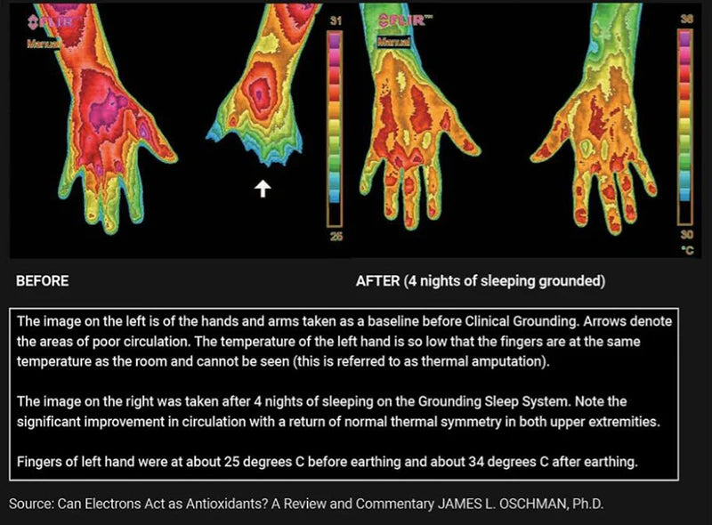 Anxiety Relief & Better Sleep Earthing Wristband Soft PU Grounding Mat