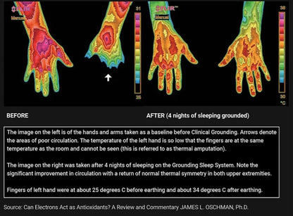 Anxiety Relief & Better Sleep Earthing Wristband Soft PU Grounding Mat