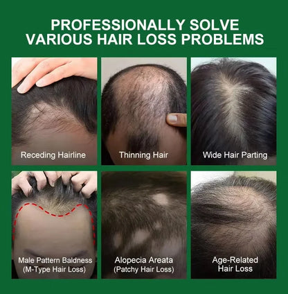 Fast Hair Growth Serum Spray - Anti Hair Loss & Baldness Treatment, Scalp Repair for Men & Women