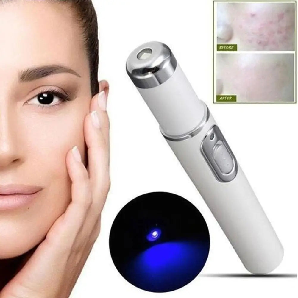 Blue Light Therapy Acne Laser Pen - LED Face Light for Scar & Wrinkle Removal Skin Care Device