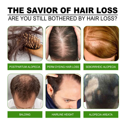 Fast Hair Growth Serum Spray - Anti Hair Loss & Baldness Treatment, Scalp Repair for Men & Women