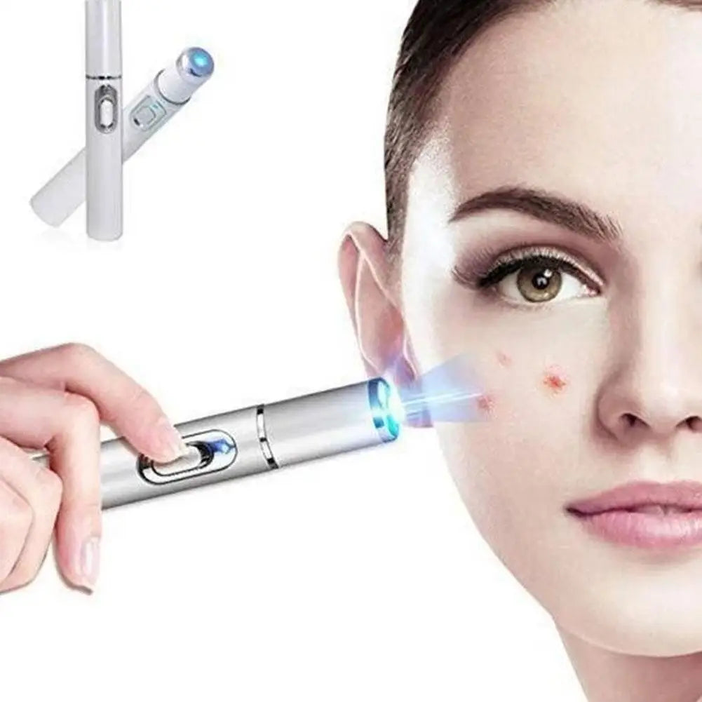 Blue Light Therapy Acne Laser Pen - LED Face Light for Scar & Wrinkle Removal Skin Care Device
