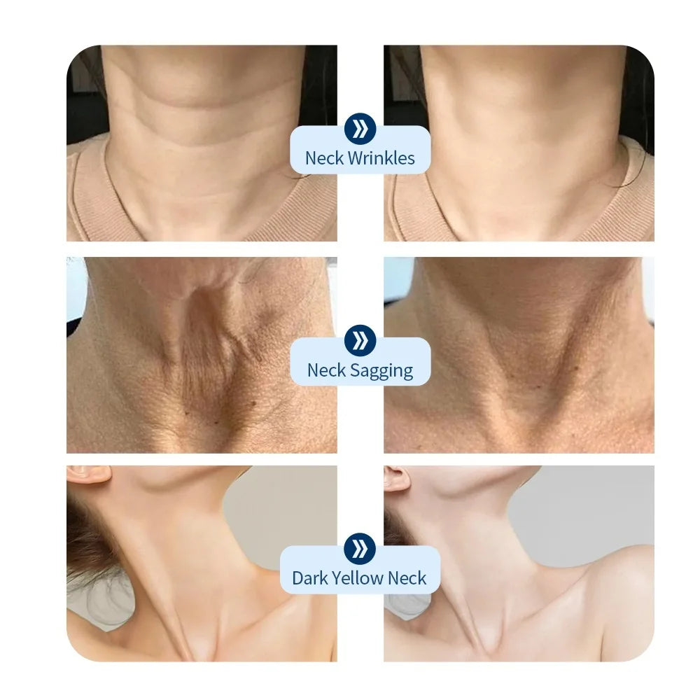 Neck LED Lift Mask - Photon Skin Tightening & Anti-Wrinkle Beauty Device for Neck Rejuvenation