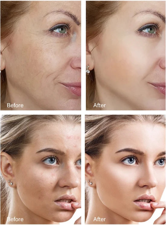 Retinol Wrinkle Remover Face Cream - Firming, Anti-Aging & Moisturizing Skin Care