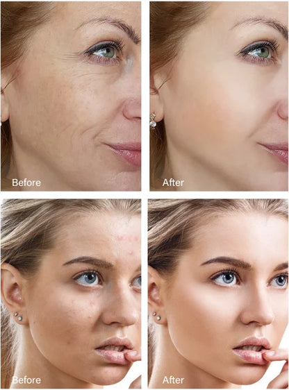 Retinol Wrinkle Remover Face Cream - Firming, Anti-Aging & Moisturizing Skin Care