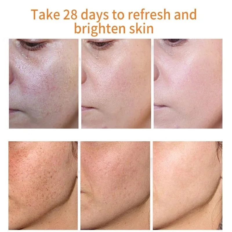 Retinol Wrinkle Remover Face Cream - Firming, Anti-Aging & Moisturizing Skin Care