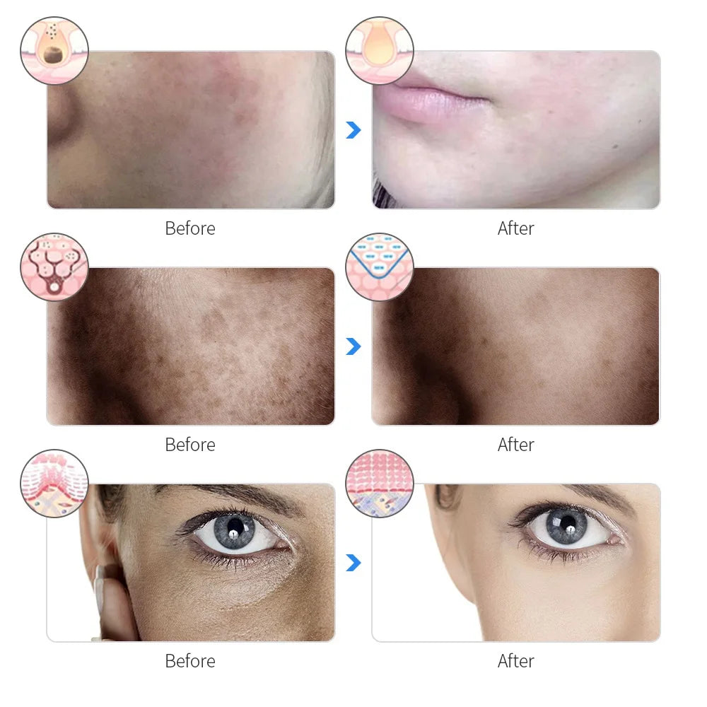 7-Color LED Photon Facial Mask - Skin Rejuvenation & Tightening for Face & Neck
