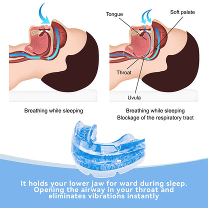 Anti Snore Bruxism Mouth Guard Sleep Aid Apnea Device