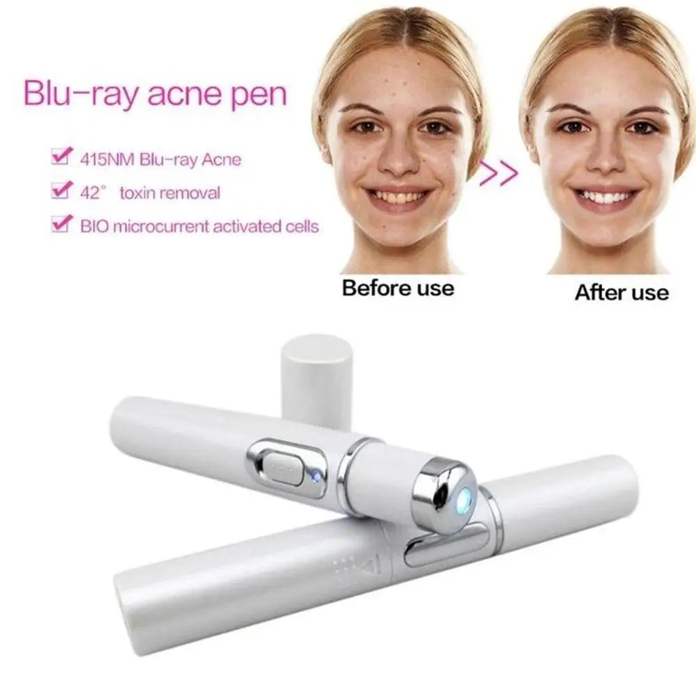 Blue Light Therapy Acne Laser Pen - LED Face Light for Scar & Wrinkle Removal Skin Care Device