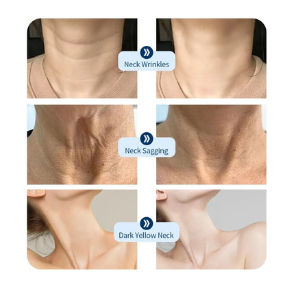 Neck LED Lift Mask - Photon Skin Tightening & Anti-Wrinkle Beauty Device for Neck Rejuvenation