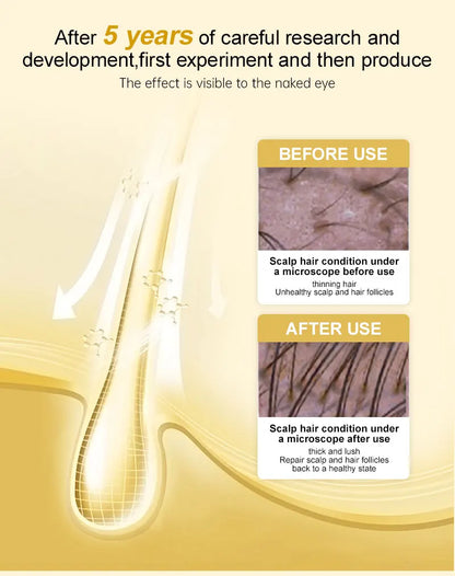 PURC Hair Growth Serum for Thinning Hair Loss Treatment Fast Regrowth Oil for Men & Women Hair Care