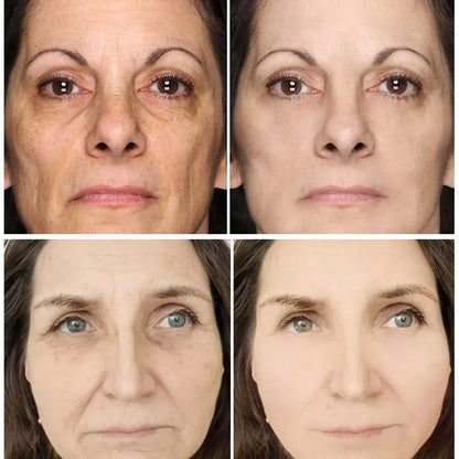 Retinol Wrinkle Remover Face Cream - Firming, Anti-Aging & Moisturizing Skin Care