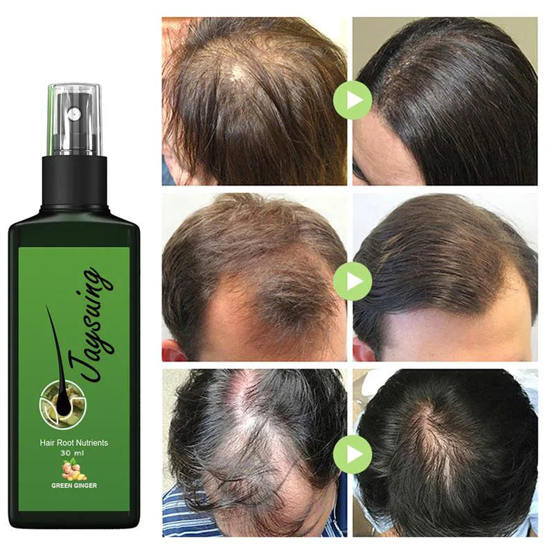 Fast Hair Growth Serum Spray - Anti Hair Loss & Baldness Treatment, Scalp Repair for Men & Women