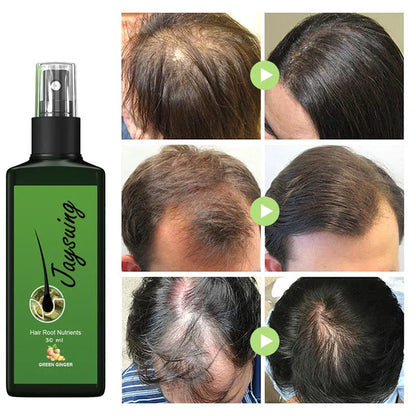 Fast Hair Growth Serum Spray - Anti Hair Loss & Baldness Treatment, Scalp Repair for Men & Women