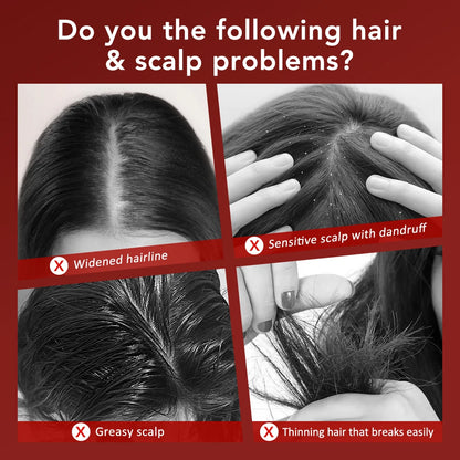 Anti Hair Loss Care Electric Vibration Massage Comb