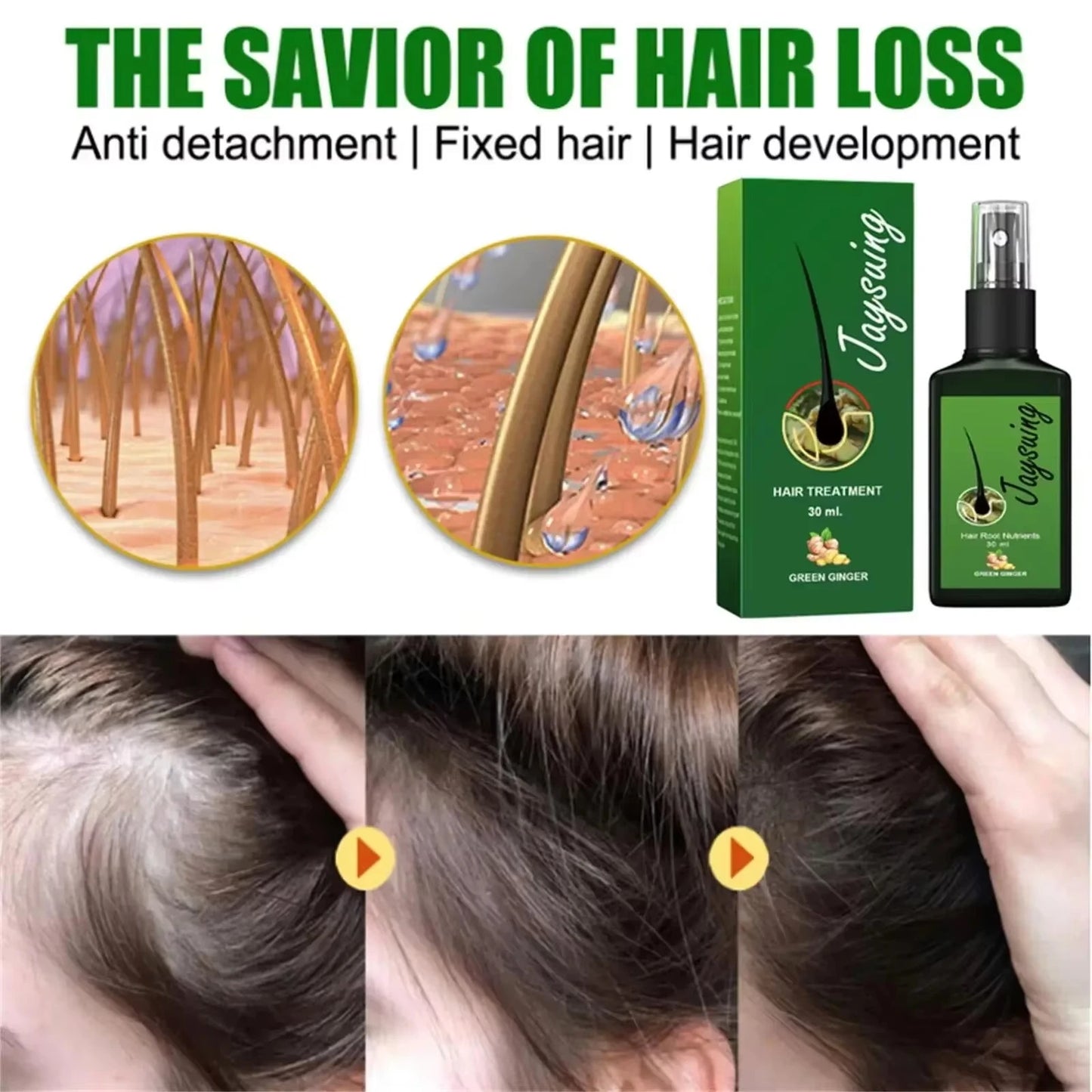 Fast Hair Growth Serum Spray - Anti Hair Loss & Baldness Treatment, Scalp Repair for Men & Women