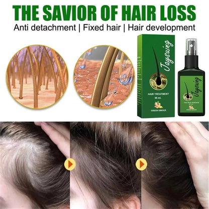 Fast Hair Growth Serum Spray - Anti Hair Loss & Baldness Treatment, Scalp Repair for Men & Women
