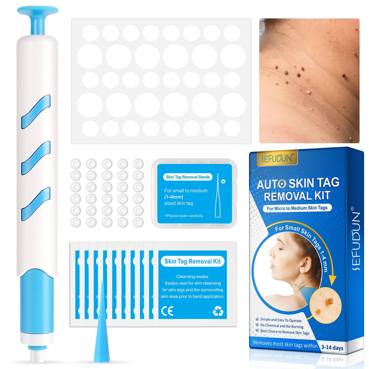 3 In 1 Painless Auto Skin Tag Mole Wart Removal Kit