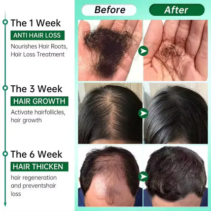 Fast Hair Growth Serum Spray - Anti Hair Loss & Baldness Treatment, Scalp Repair for Men & Women
