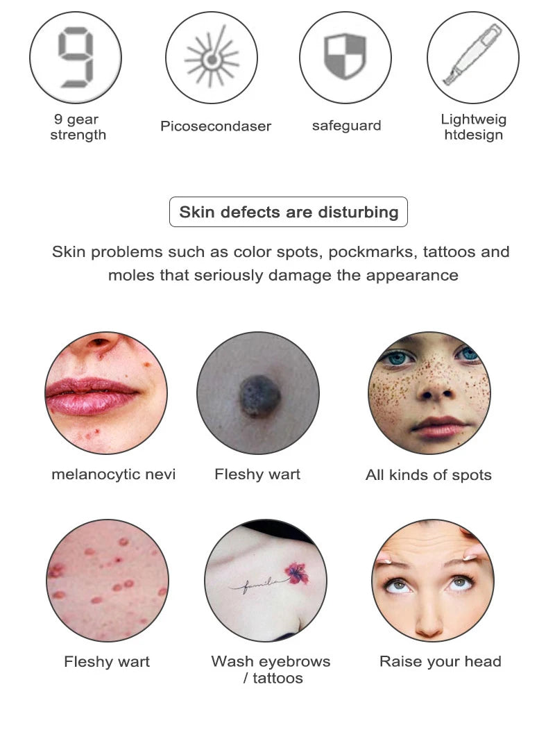 Picosecond Laser Pointer - Mole, Dark Spot & Tattoo Removal Pen for Skin Pigment and Acne Treatment