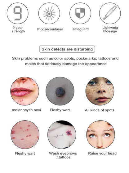 Picosecond Laser Pointer - Mole, Dark Spot & Tattoo Removal Pen for Skin Pigment and Acne Treatment