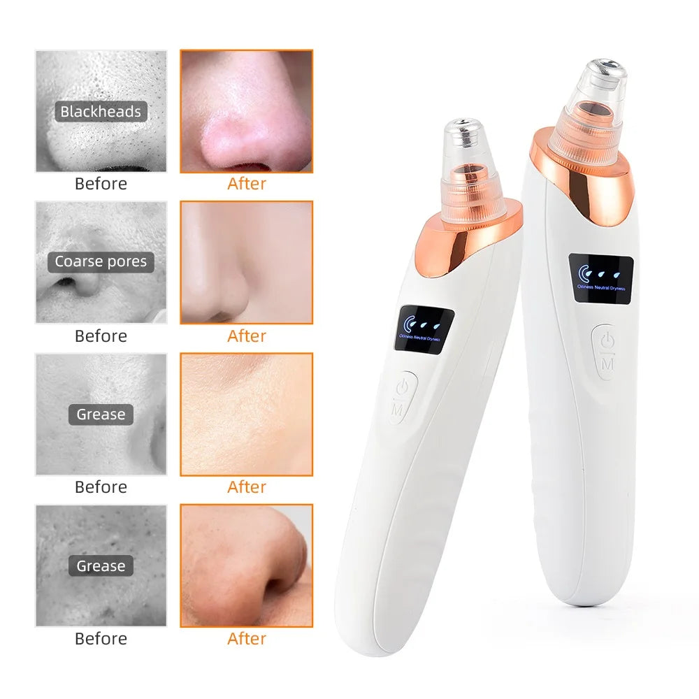 Vacuum Nose Blackhead Remover Facial Suction Cleaner Pimple & Dead Skin Extractor