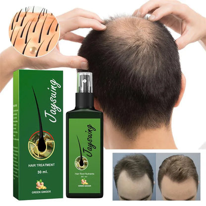 Fast Hair Growth Serum Spray - Anti Hair Loss & Baldness Treatment, Scalp Repair for Men & Women