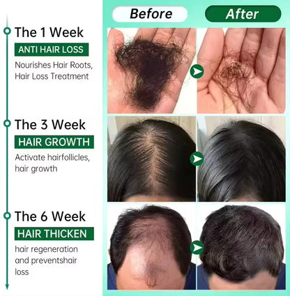 Fast Hair Growth Serum Spray - Anti Hair Loss & Baldness Treatment, Scalp Repair for Men & Women